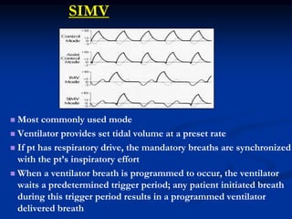 Basics of mechanical ventilation | PPSX