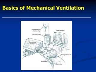 Basics of Mechanical Ventilation
 