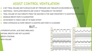 Basics of mechanical ventilation | PPTX