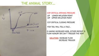 Ccp Flow Basics of mechanical ventilation | PPTX