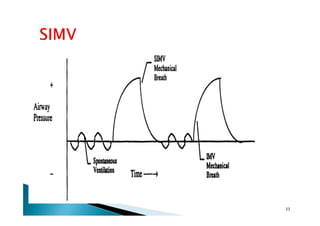 Basics of Mechanical Ventilation (SIPHW).pdf