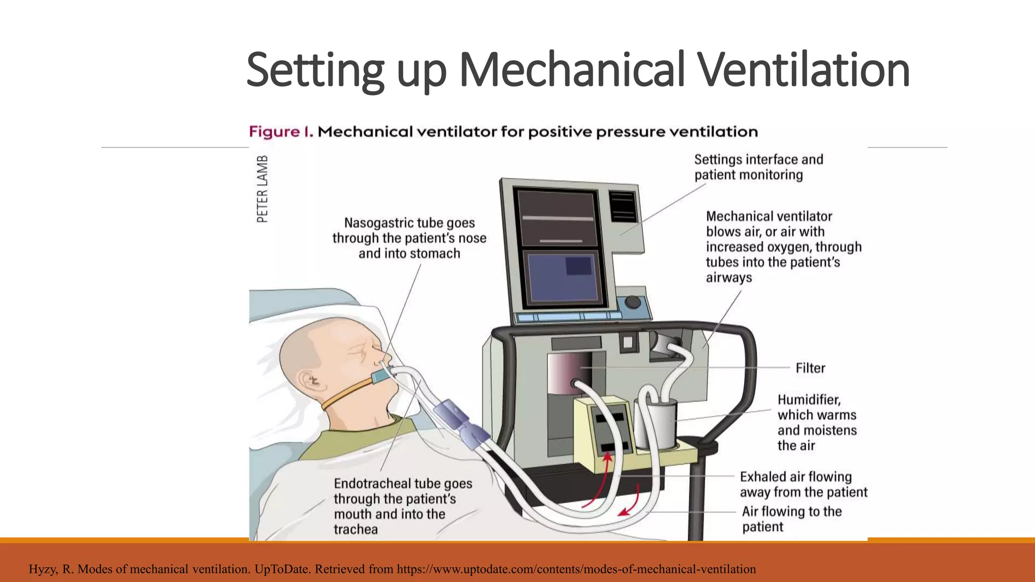 Setting up Mechanical Ventilation
Hyzy, R. Modes of mechanical ventilation. UpToDate. Retrieved from https://www.uptodate.com/contents/modes-of-mechanical-ventilation
 