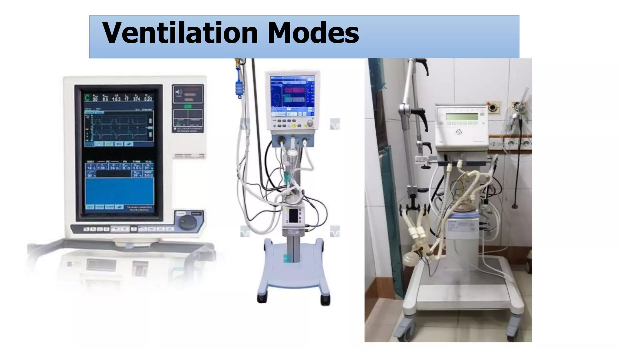 Ventilation Modes
 