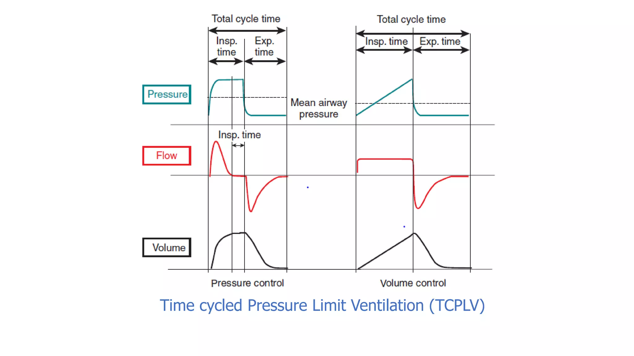 Time cycled Pressure Limit Ventilation (TCPLV)
 