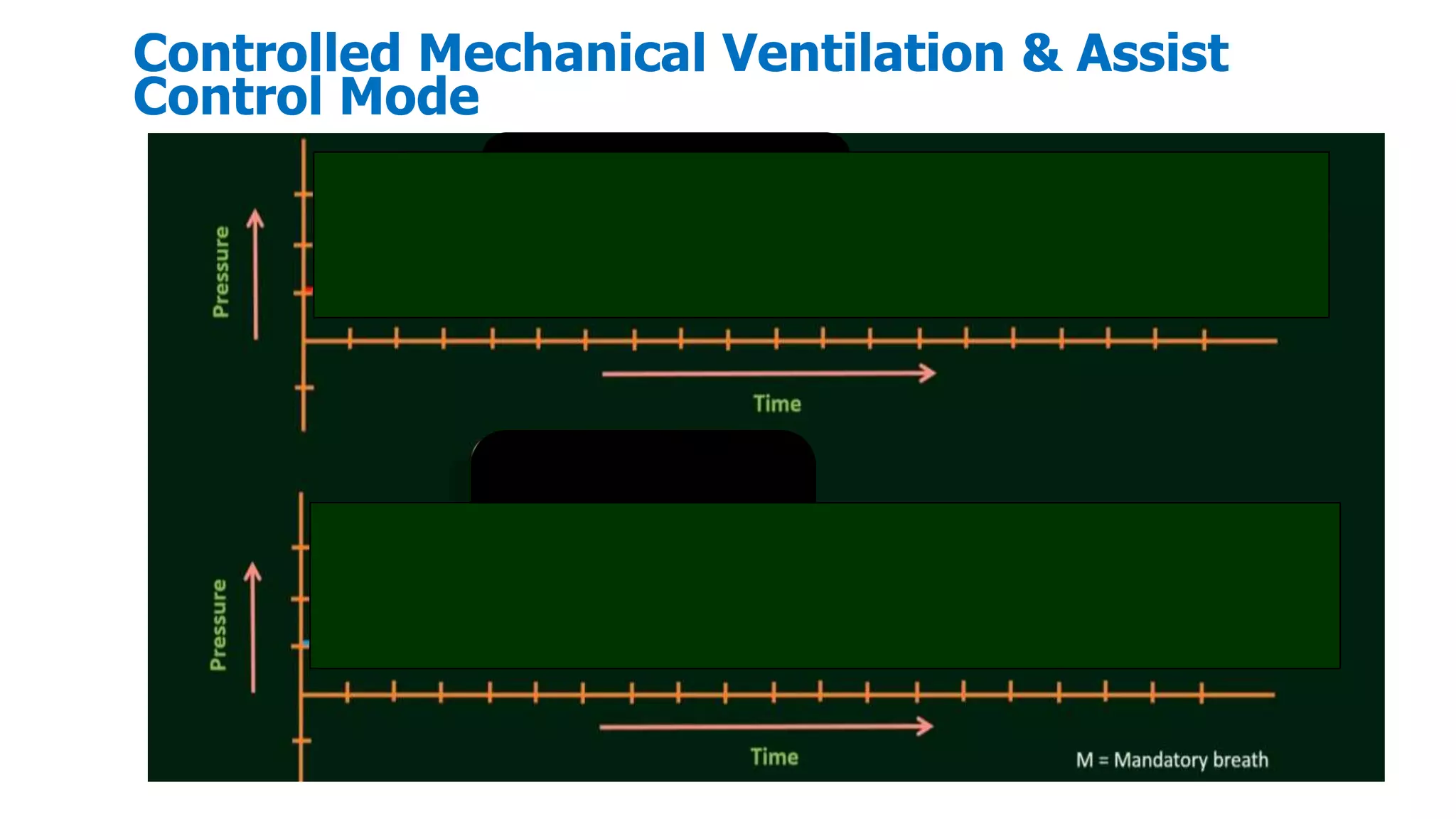 Controlled Mechanical Ventilation & Assist
Control Mode
 