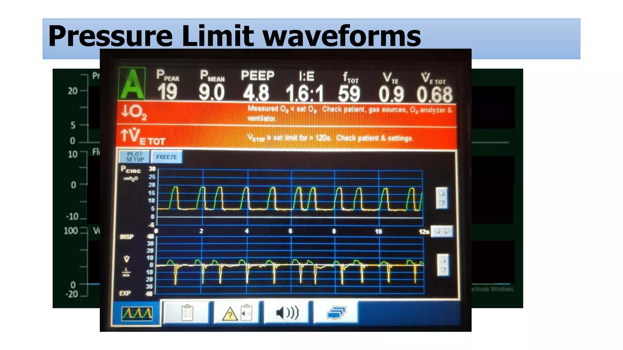 Pressure Limit waveforms
 