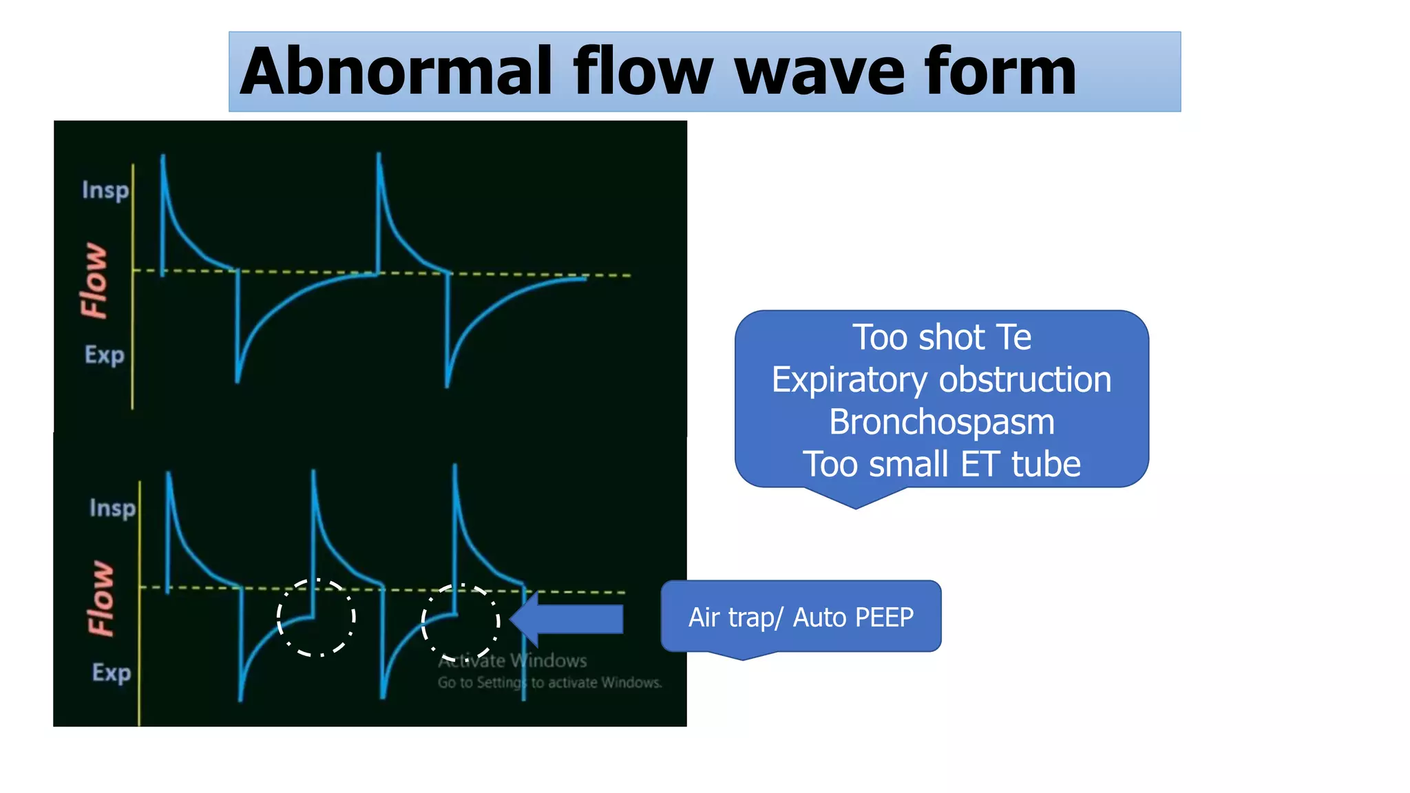 Abnormal flow wave form
Too shot Te
Expiratory obstruction
Bronchospasm
Too small ET tube
Air trap/ Auto PEEP
 