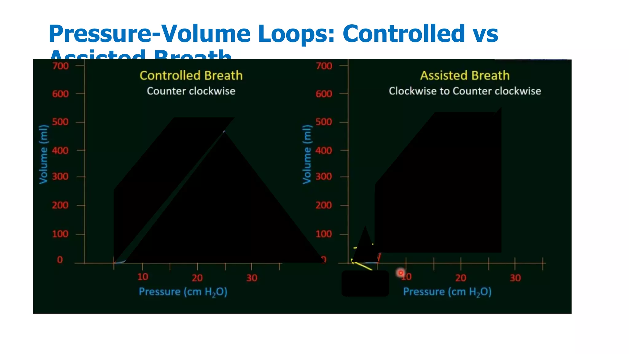 Pressure-Volume Loops: Controlled vs
Assisted Breath
 