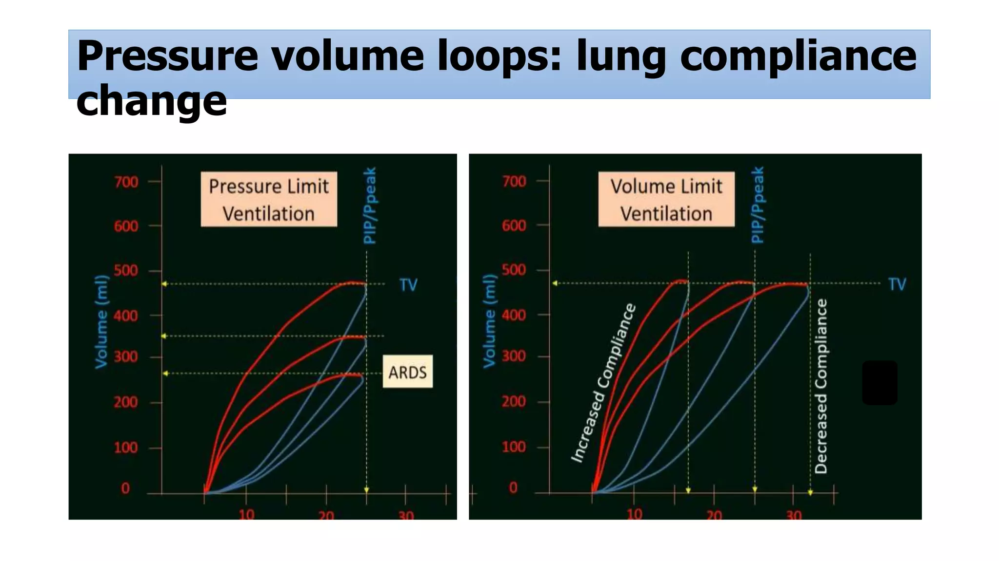 Pressure volume loops: lung compliance
change
 