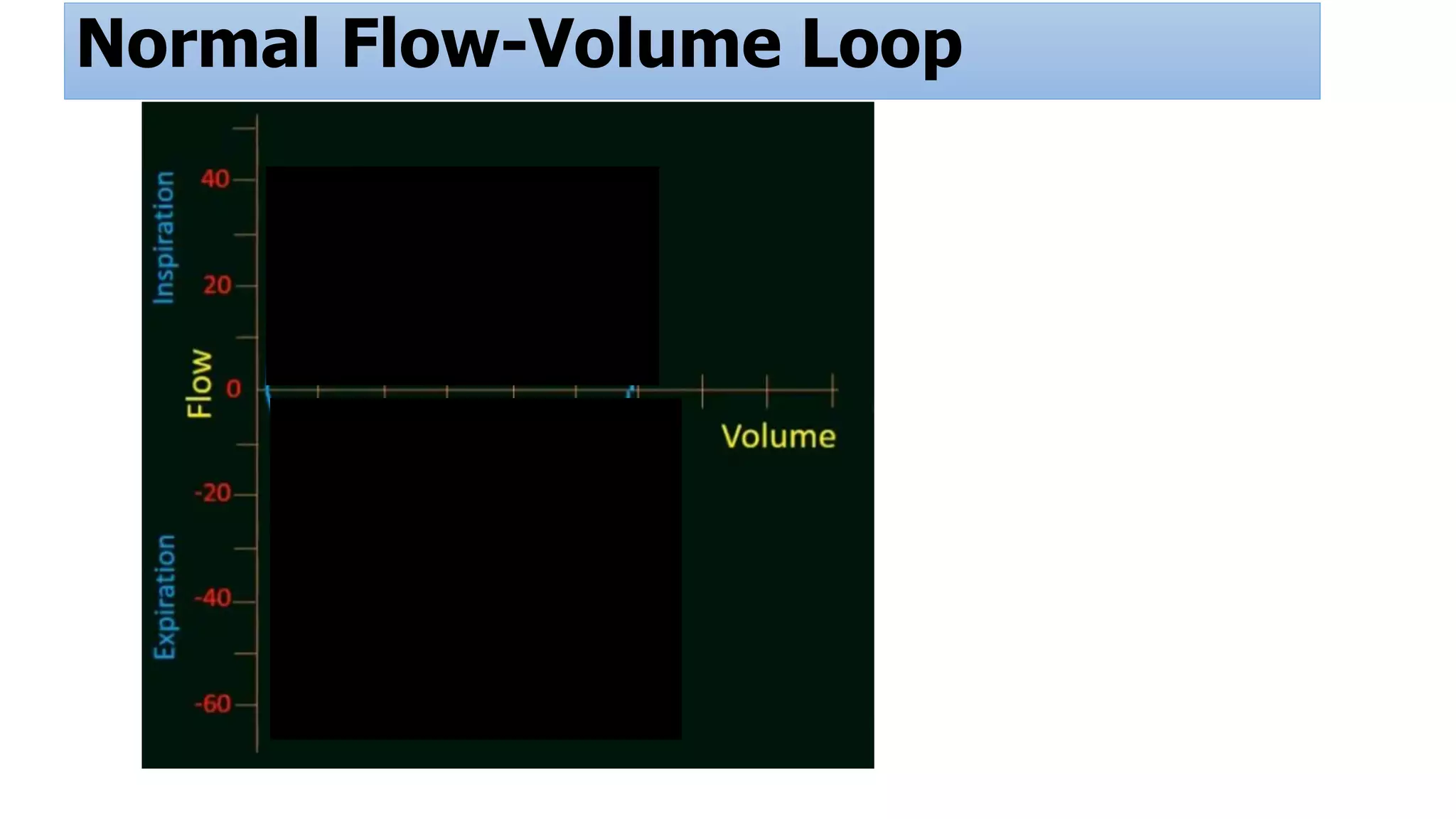 Normal Flow-Volume Loop
 