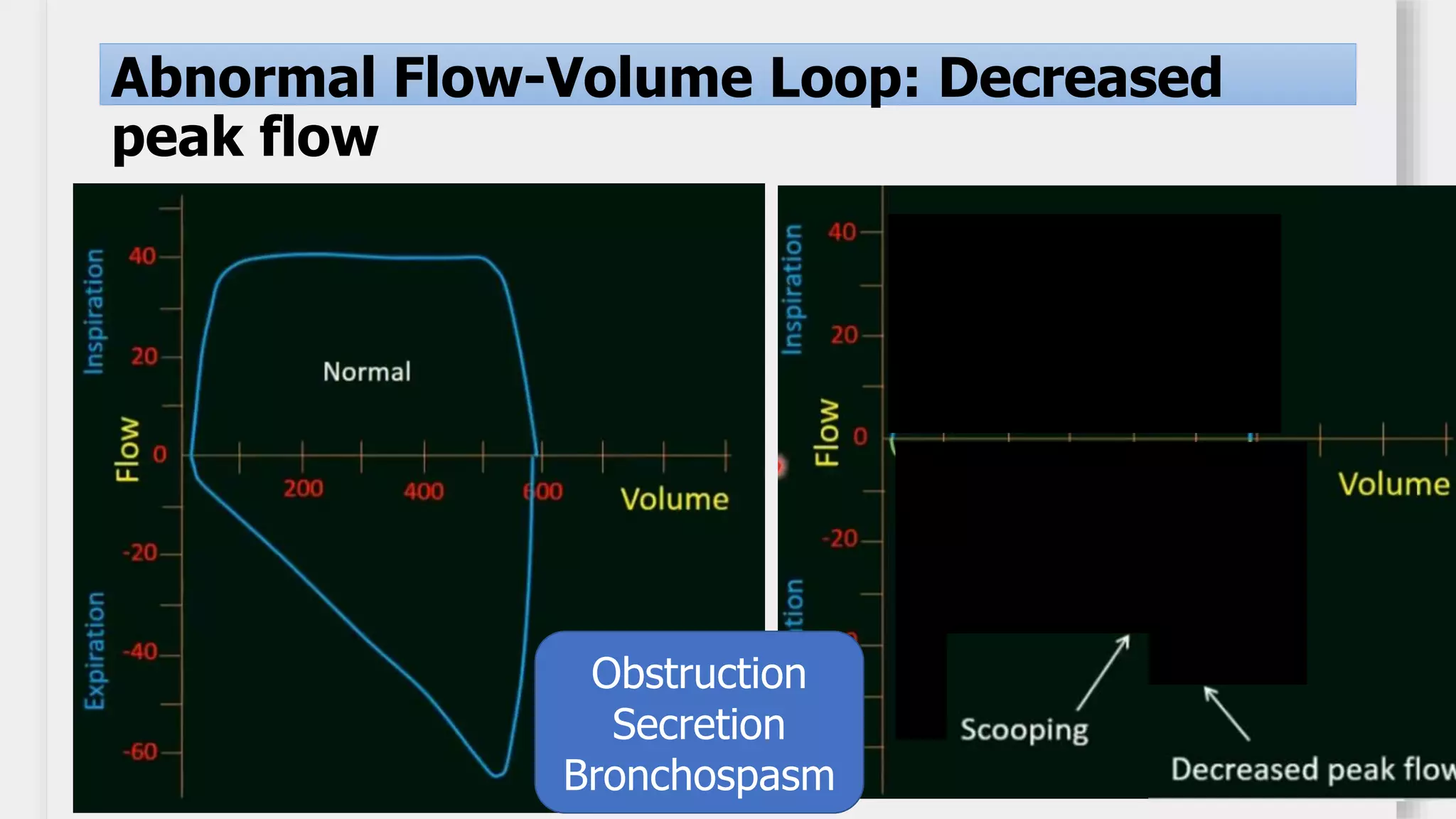 Basics
Adequac
y
Abnormal Flow-Volume Loop: Decreased
peak flow
Obstruction
Secretion
Bronchospasm
 