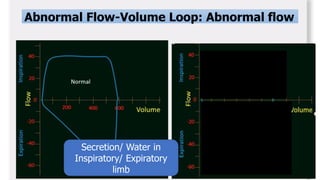 basics of mechanical ventilator Dr Asaduzzaman.pptx
