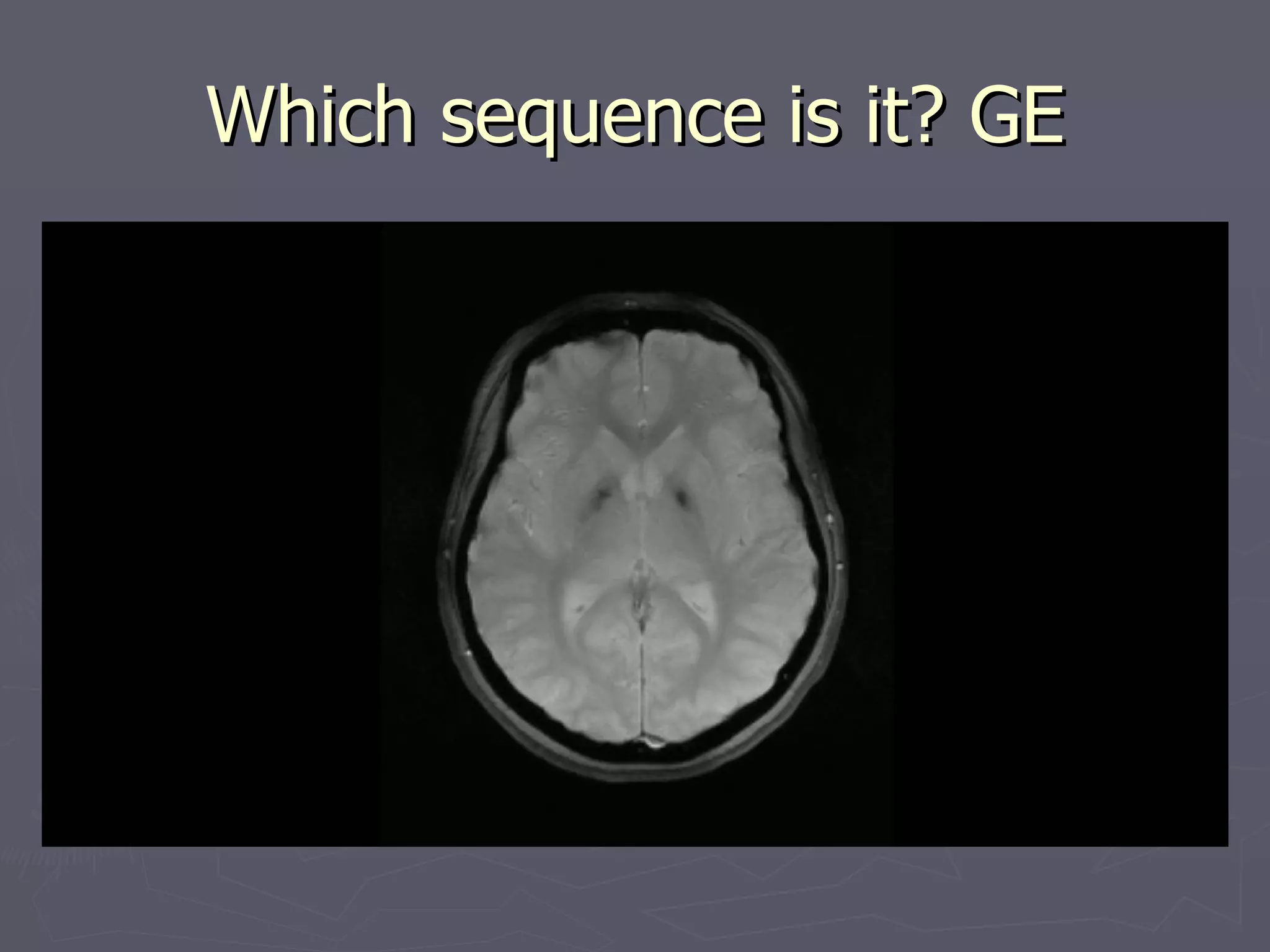 Which sequence is it? GE 