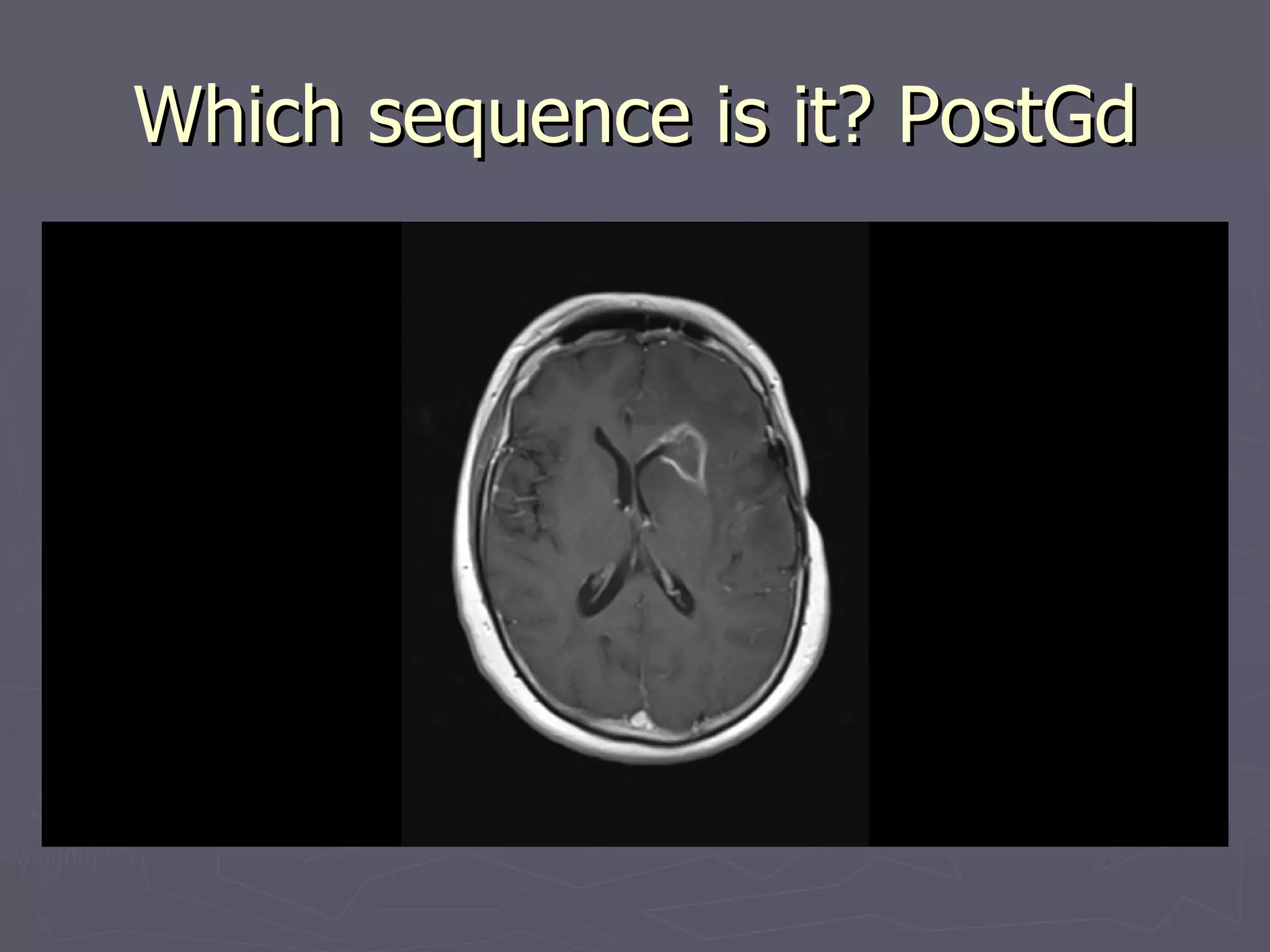 Which sequence is it? PostGd 