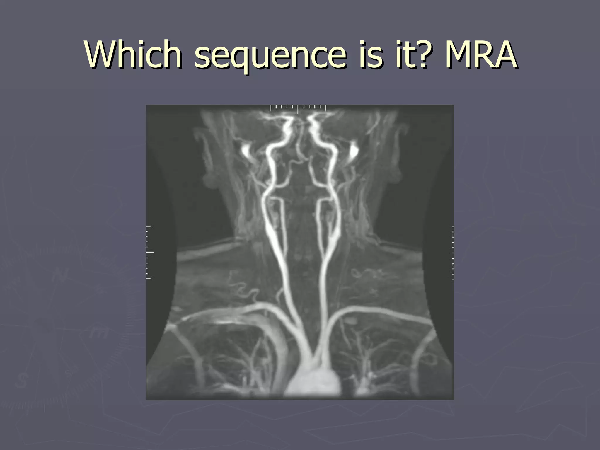 Which sequence is it? MRA 