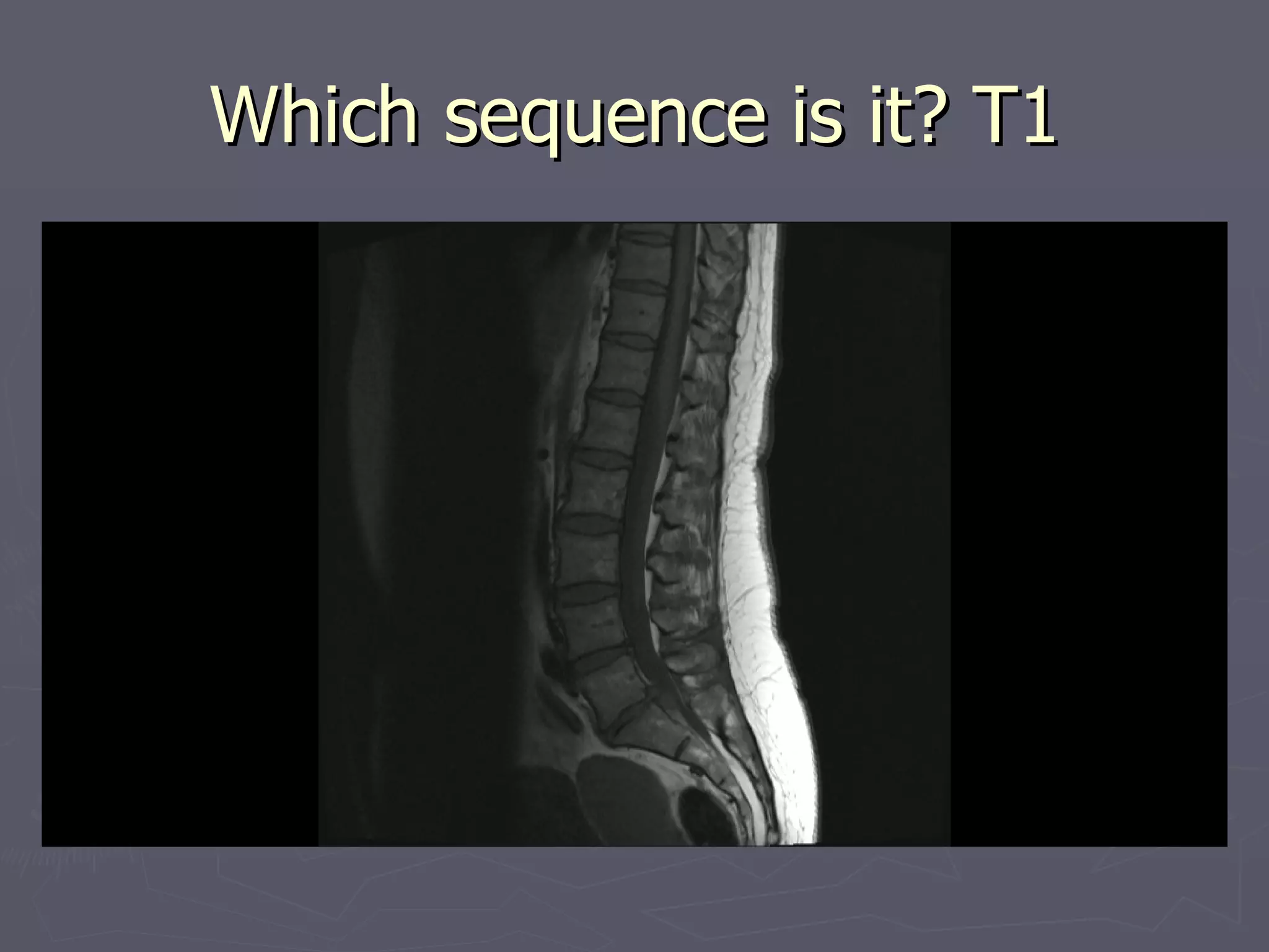 Which sequence is it? T1 