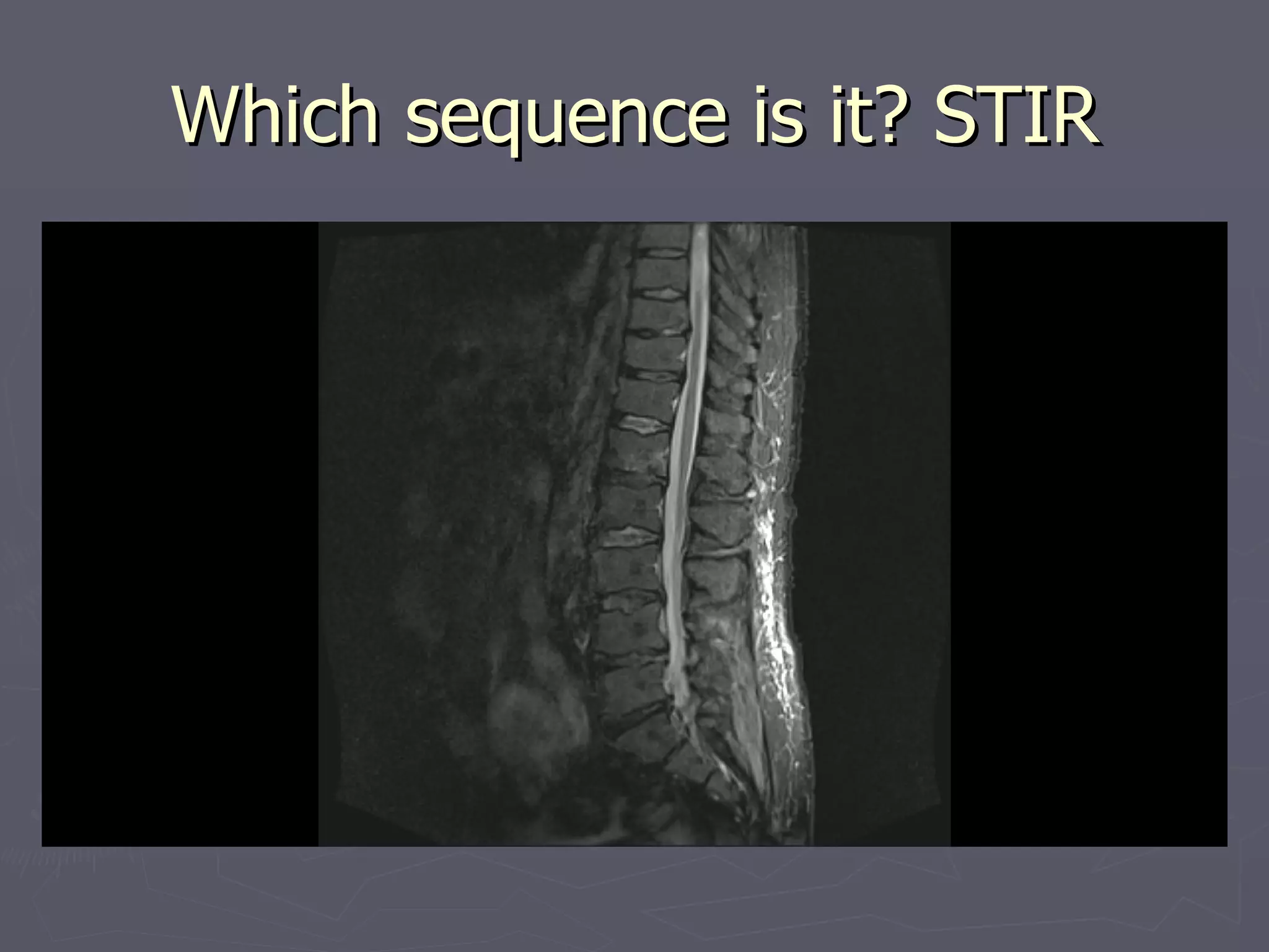 Which sequence is it? STIR 