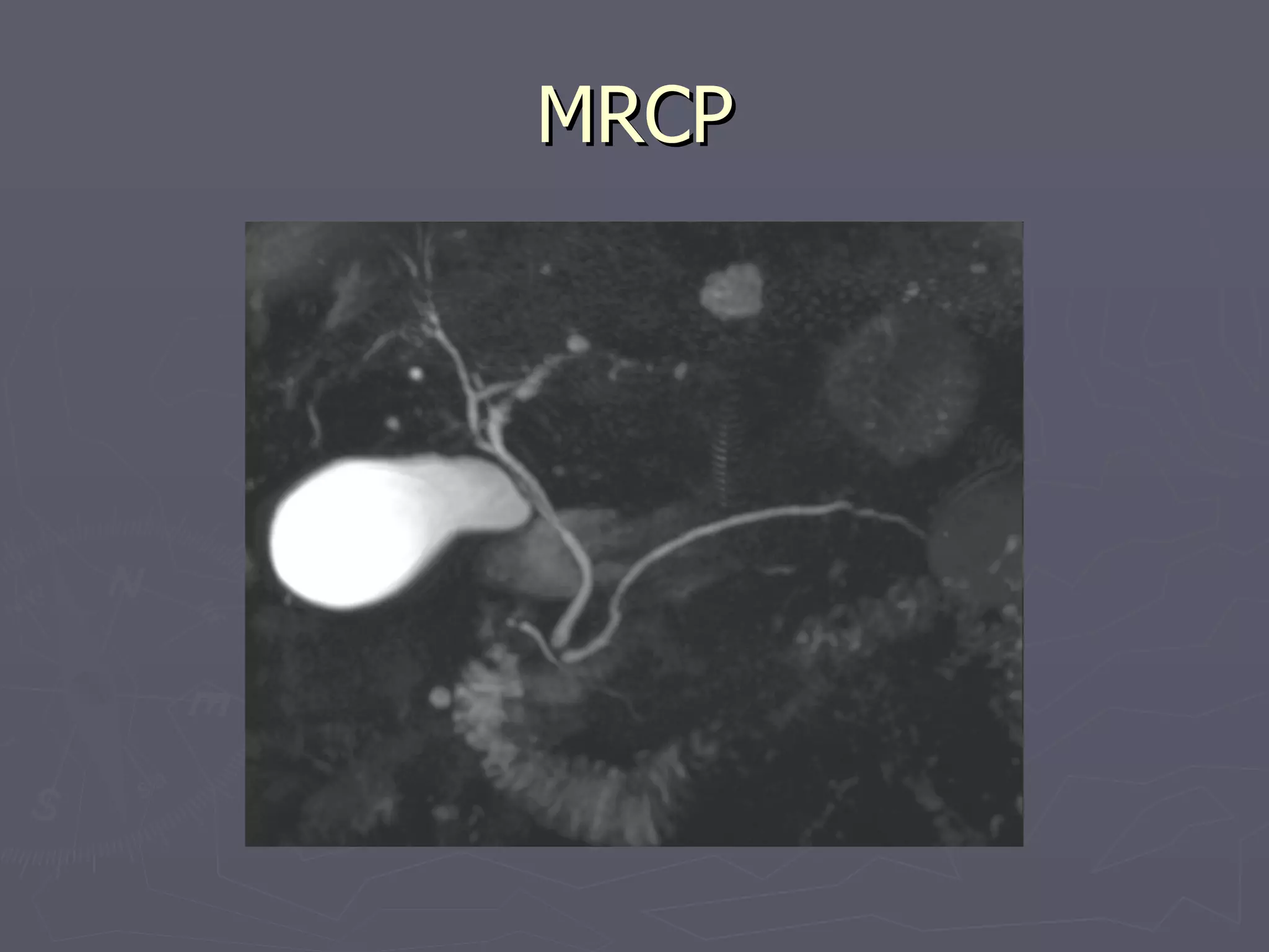 MRCP 