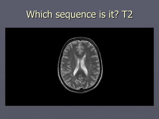 Which sequence is it? T2 