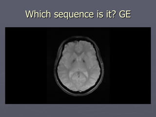 Which sequence is it? GE 