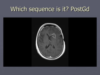 Which sequence is it? PostGd 