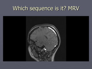 Which sequence is it? MRV 