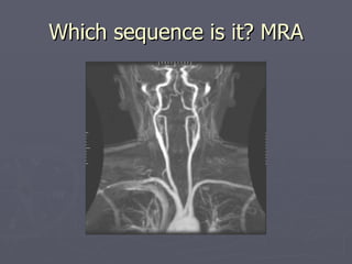 Which sequence is it? MRA 