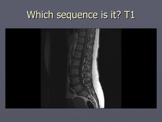 Which sequence is it? T1 