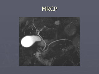 MRCP 