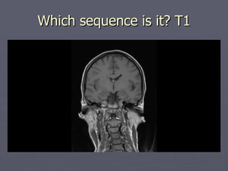 Which sequence is it? T1 