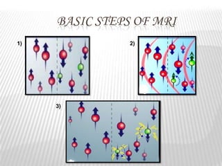 BASIC STEPS OF MRI
1)              2)




     3)
 
