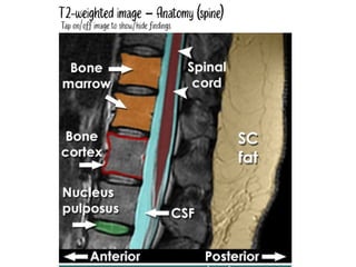 Mri Basic Parts BASICS OF MRI interpretation and imaging.pptx