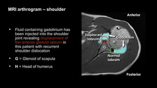 Basics of MRI interpretation (December 2022) | PPTX