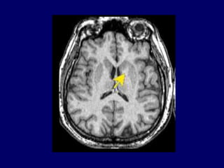 Basics of mri physics Dr. Muhammad Bin Zulfiqar | PPTX