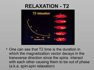 Basics of MRI Physics -Dr Sumit Sharma.pptx