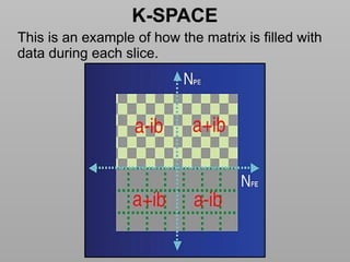 Basics of MRI Physics -Dr Sumit Sharma.pptx