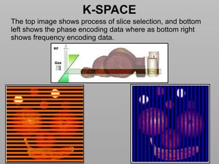 Basics of MRI Physics -Dr Sumit Sharma.pptx