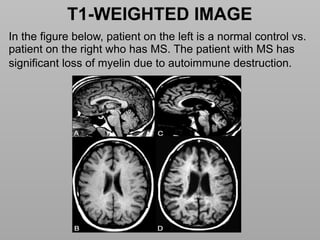 Basics of MRI Physics -Dr Sumit Sharma.pptx