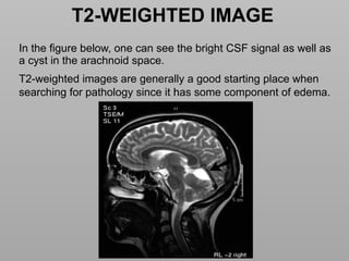 Basics of MRI Physics -Dr Sumit Sharma.pptx