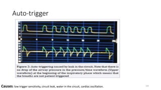 Auto-trigger
Causes: low trigger sensitivity, circuit leak, water in the circuit, cardiac oscillation. 104
 