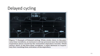 Delayed cycling
108
 