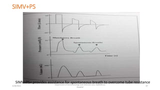 SIMV+PS
SIMV+PS= provides assistance for spontaneous breath to overcome tube resistance
5/28/2021
Department of Anesthesiology and intensive care, Dadeldhura
Hospital
47
 