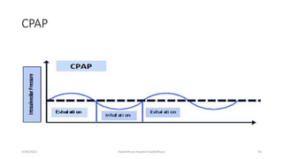 CPAP
5/28/2021 Dadeldhura Hospital Dadeldhura 50
 