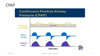 CPAP
5/28/2021 Dadeldhura Hospital Dadeldhura 51
 