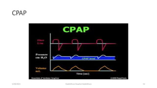 CPAP
5/28/2021 Dadeldhura Hospital Dadeldhura 52
 
