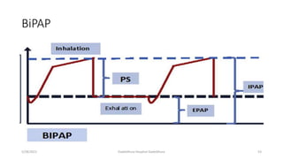 BiPAP
5/28/2021 Dadeldhura Hospital Dadeldhura 53
 