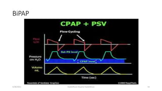 BiPAP
5/28/2021 Dadeldhura Hospital Dadeldhura 54
 