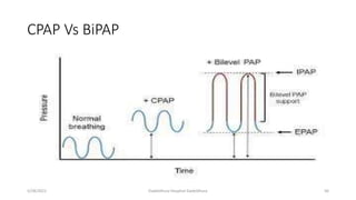 CPAP Vs BiPAP
5/28/2021 Dadeldhura Hospital Dadeldhura 56
 