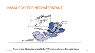 NASAL CPAP FOR NEONATE/INFANT
Nasal prong/Nasopharyngral tube/ET tube can be use for nasal cpap
5/28/2021
Department of Anesthesiology and intensive care, Dadeldhura
Hospital
69
 