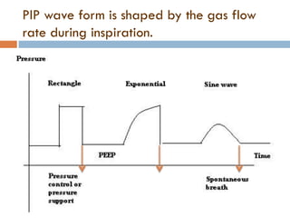 Basics of neonatal ventilation 1 | PDF